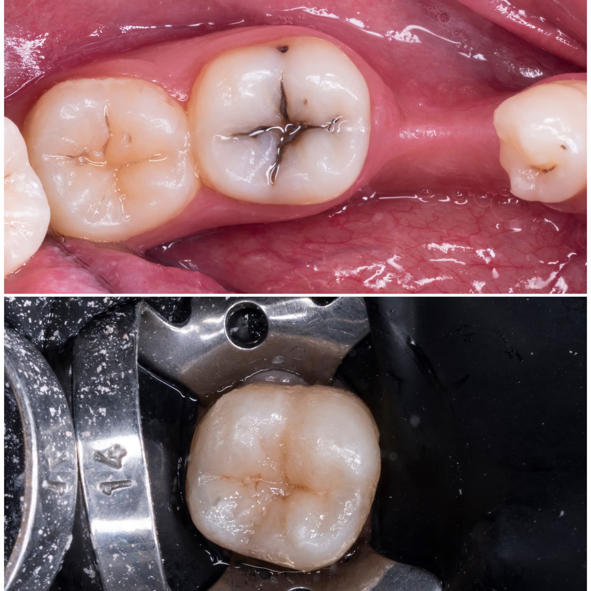 Biomimetic Restoration