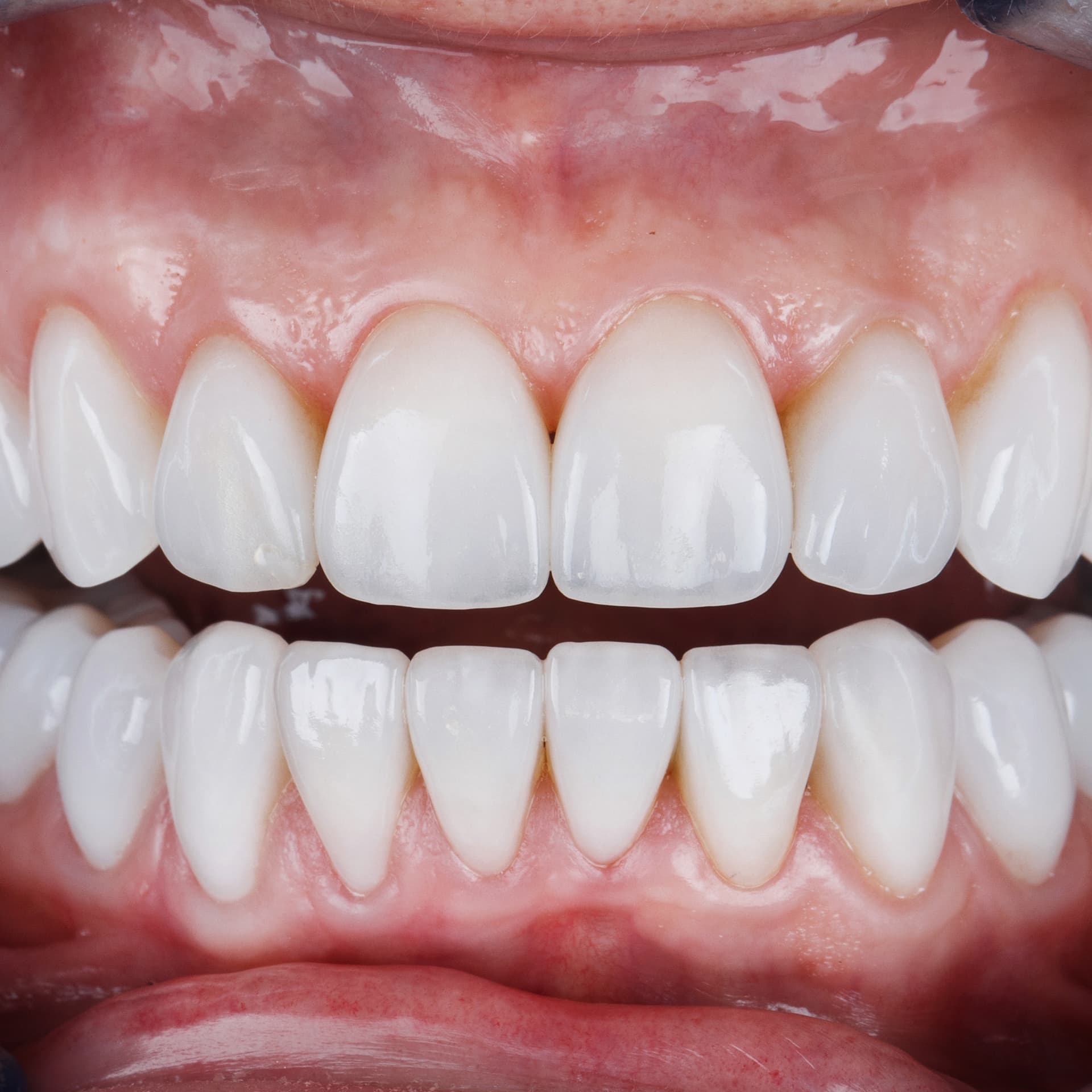 Rehabilitation at Prime Oral Dental Clinic
